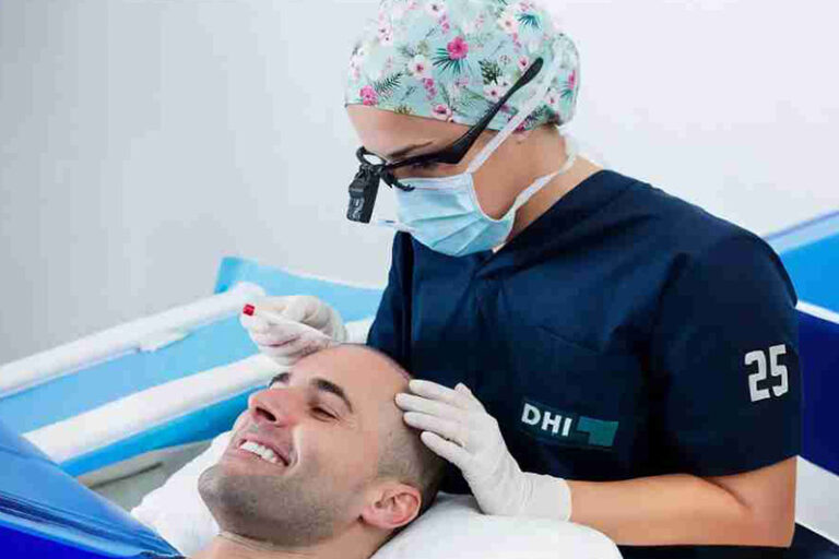 Diferencias entre Técnica DHI y FUE: Guía Completa para Elegir tu Injerto Capilar